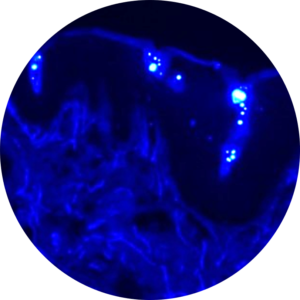 In Vitro Permeation Testing Ivpt Pkderm
